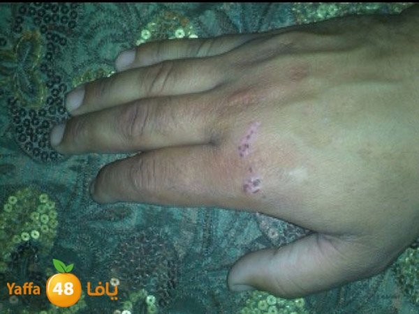 phoneludinjury (7).JPG